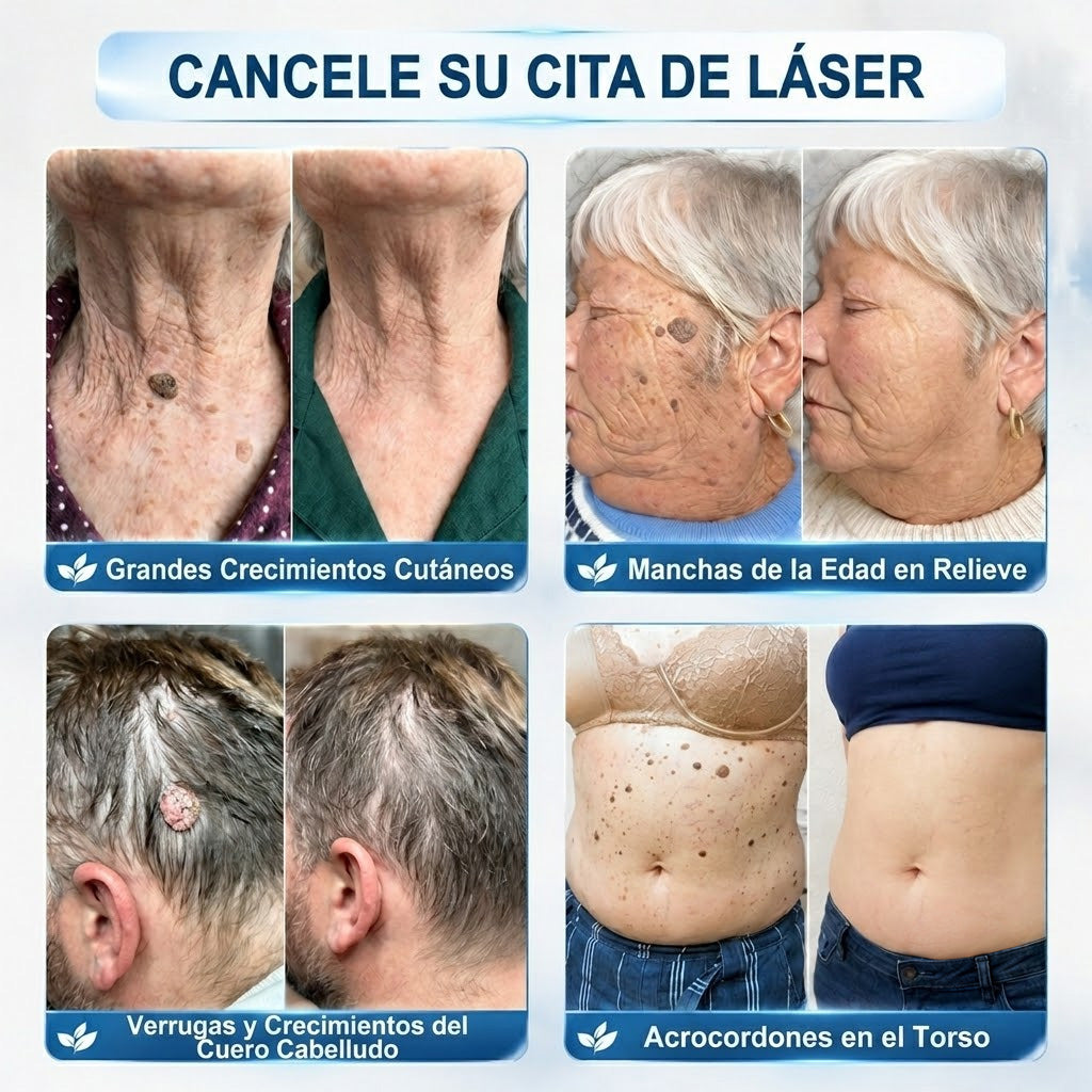 Instalación registrada ante COFEPRIS丨🧩 Eliminador de acrocordones y manchas en 7 días Pluma roll-on avanzada, sin dolor y sin dejar cicatrices