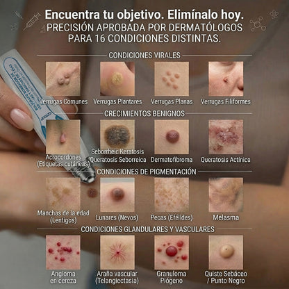 Instalación registrada ante COFEPRIS丨🧩 Eliminador de acrocordones y manchas en 7 días Pluma roll-on avanzada, sin dolor y sin dejar cicatrices