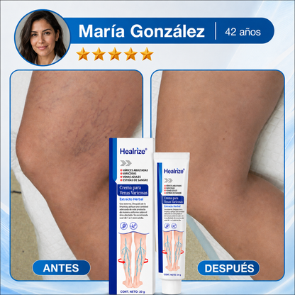 Healrize® Crema de Cuidado y Confort para Piernas