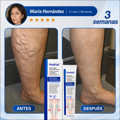 Healrize® Crema de Cuidado y Confort para Piernas