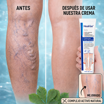 Healrize® Crema de Cuidado y Confort para Piernas