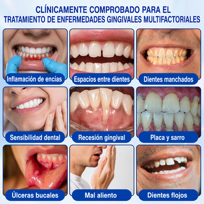 🇲🇽🍄🦷2️⃣ HEATWOLF® GumRevive Gel Reparador Periodontal