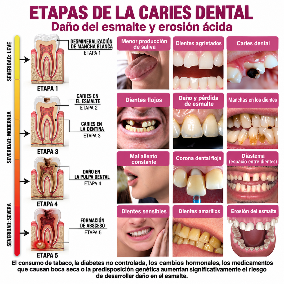HEATWOLF® DenPerm Gel Rellenador para Reparación de Caries y Esmalte Dental Natural🎈