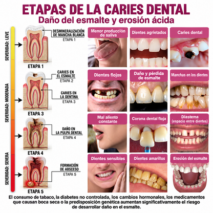 HEATWOLF® DenPerm Gel Rellenador para Reparación de Caries y Esmalte Dental Natural🎈