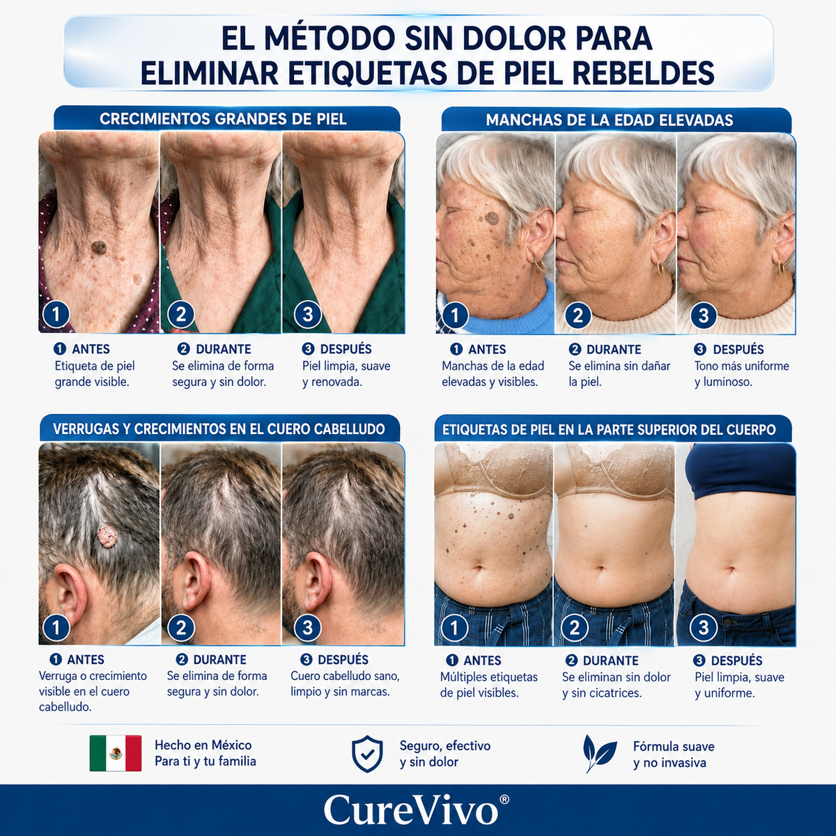 🥑2️⃣ CureVivo® Crema de 7 Días para Acrocordones y Manchas (Fórmula sin dolor · Sin cicatrices)