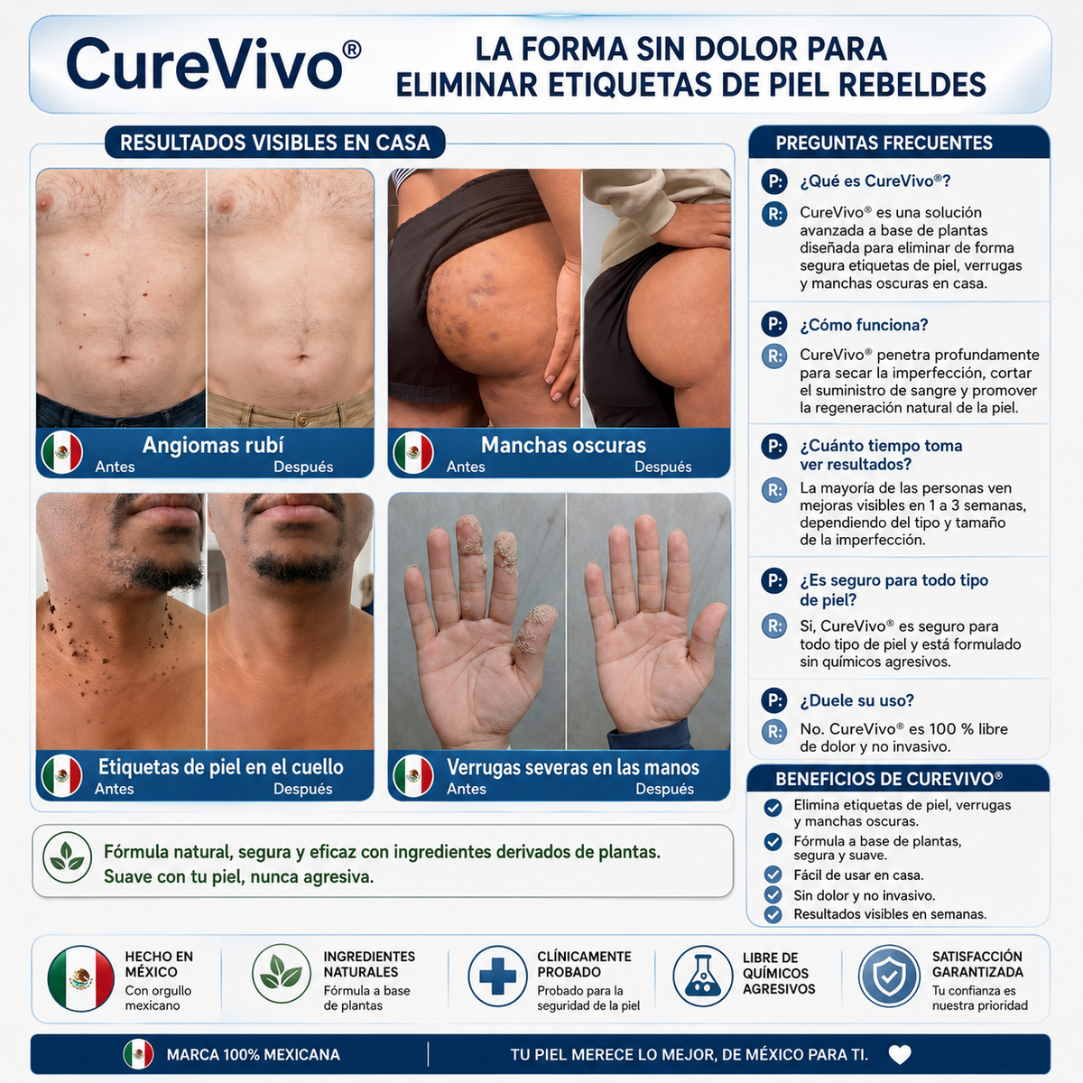 🥑2️⃣ CureVivo® Crema de 7 Días para Acrocordones y Manchas (Fórmula sin dolor · Sin cicatrices)