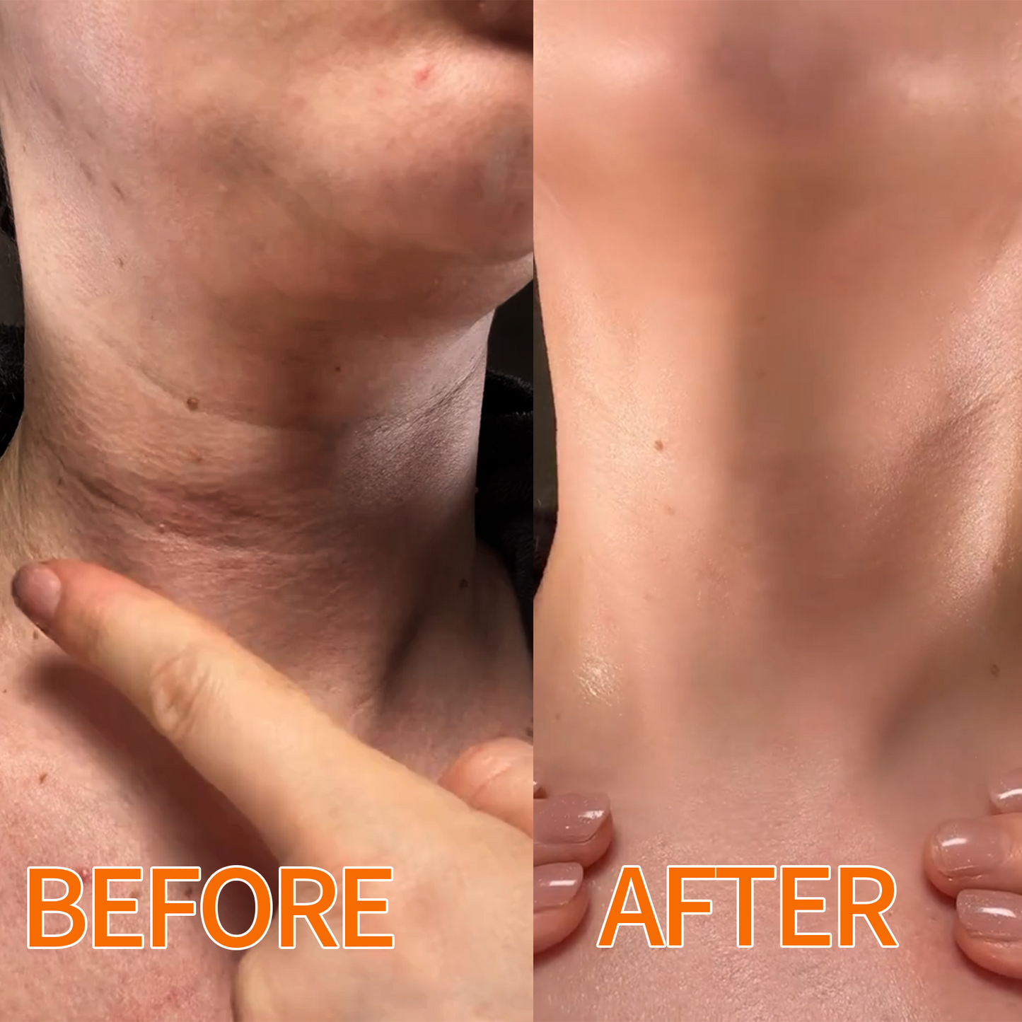 🍊Hudros® Radiant Orange Exfoliating Gel Restores skin radiance, 🛒gently removes dead skin cells, brightens the complexion, revitalizes the skin, and improves dullness and roughness.