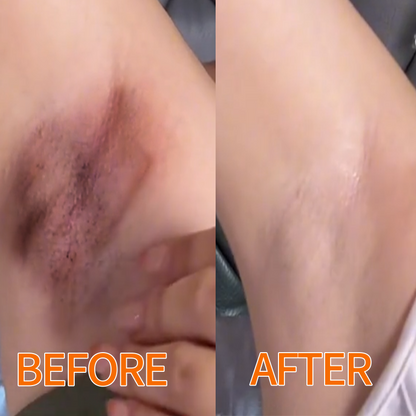 🍊Hudros® Radiant Orange Exfoliating Gel Restores skin radiance, 🛒gently removes dead skin cells, brightens the complexion, revitalizes the skin, and improves dullness and roughness.