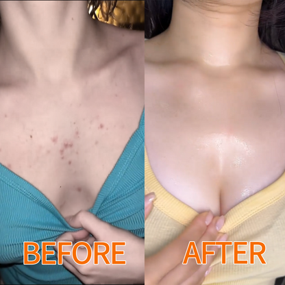 🍊Hudros® Radiant Orange Exfoliating Gel Restores skin radiance, 🛒gently removes dead skin cells, brightens the complexion, revitalizes the skin, and improves dullness and roughness.